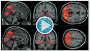 how the brain reacts when it hears stories.